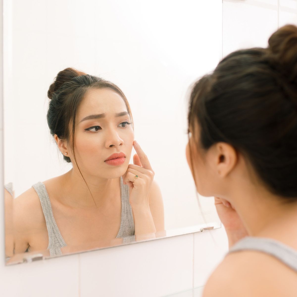 Tips Mengatasi Jerawat dan Bekasnya Secara Alami: Panduan Lengkap untuk Kulit Lebih Bersih dan Sehat