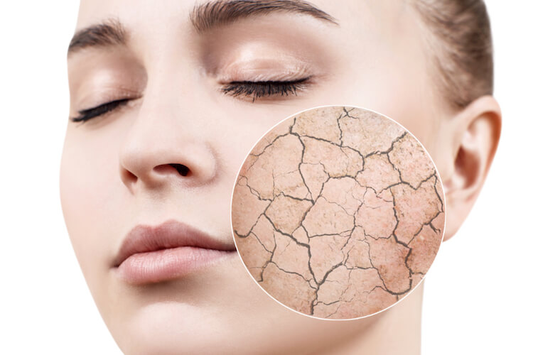 Cara Menjaga Keseimbangan pH Kulit Secara Alami