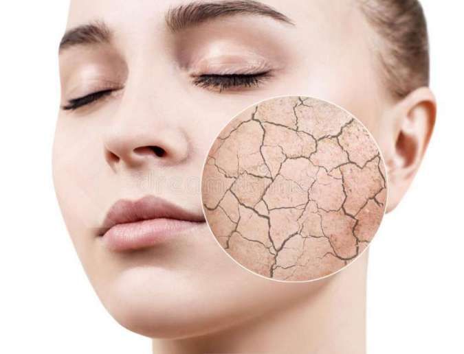 Panduan Natural untuk Mengatasi Kulit Kering dan Pecah-Pecah dengan Cara Sederhana dan Efektif